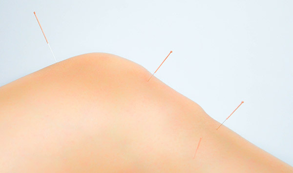 Acupuncture treatments for Musculo - Skeletal & Neurological Disorders