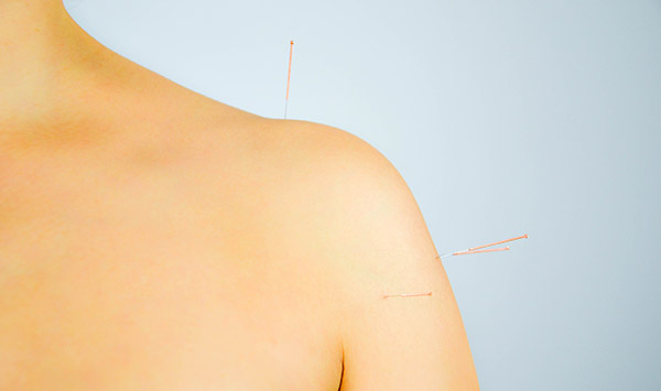 Acupuncture treatments for Dermatological Disorders