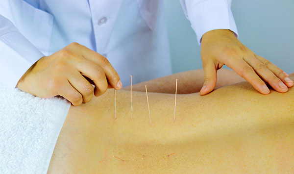Costs for acupuncture treatments at Clinic in Canterbury